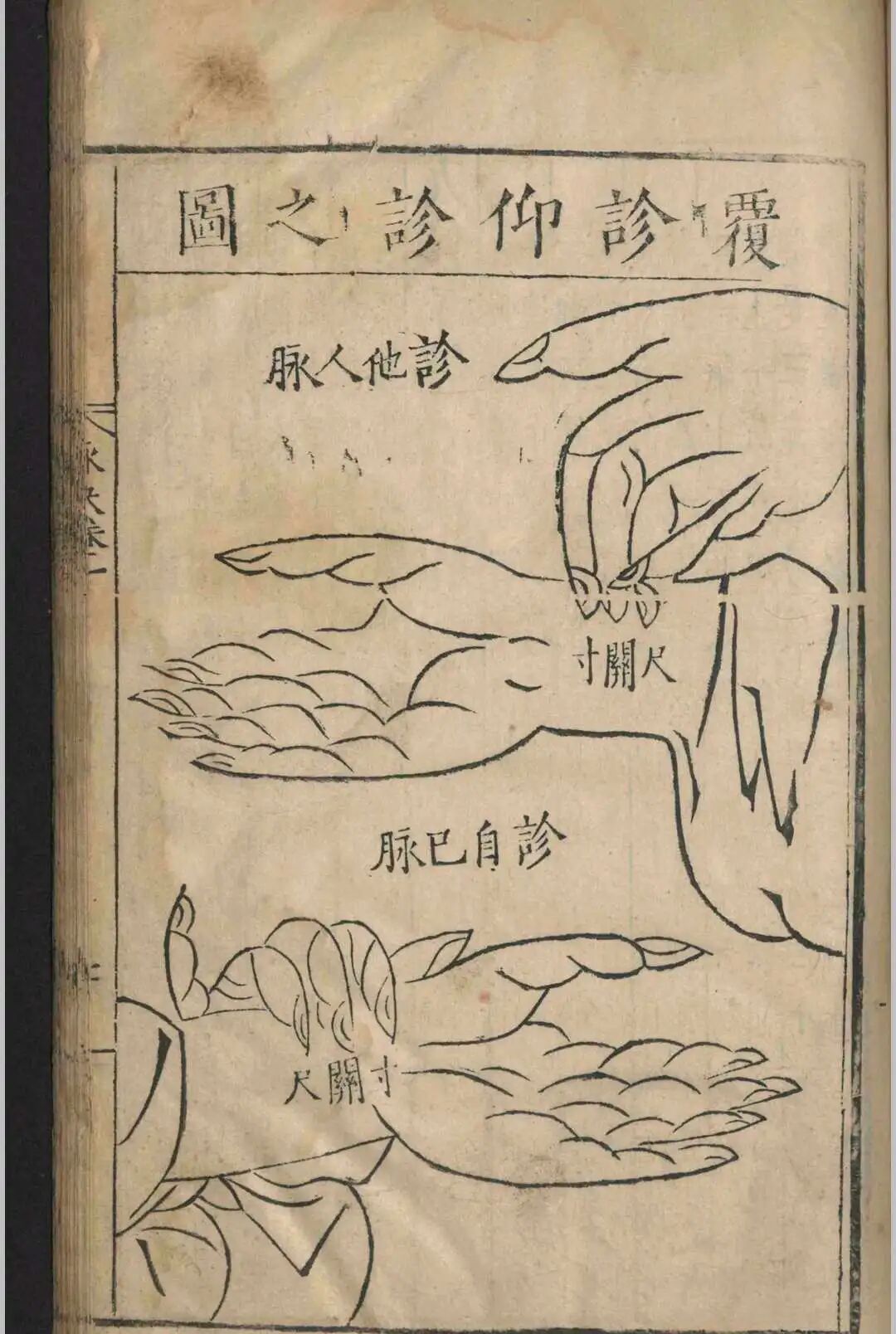 明嘉靖原版《图注王叔和脉诀》，张世贤全图注解，附方一卷，古中医脉诊经典(15)
