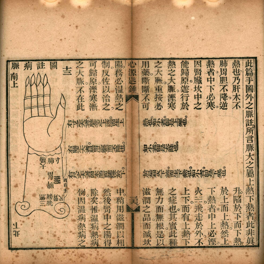 清光绪刊本《心源匙锤》，徐公桓撰脏腑经络医论古籍(9)