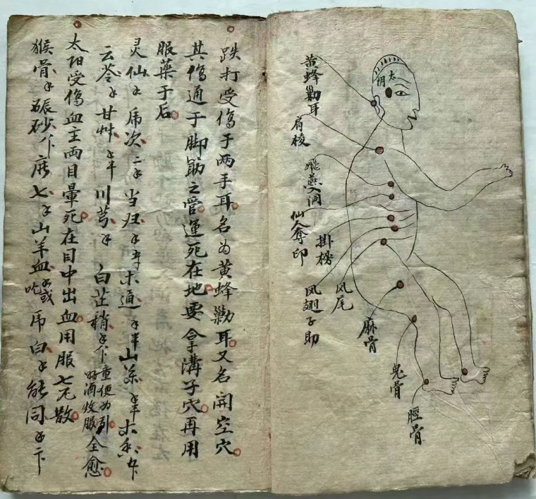 探秘中医跌打秘本：五百钱点解穴秘传(6)